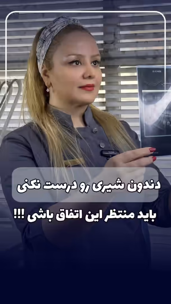 دندان شیری